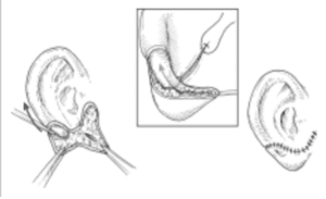 Stage 2 of the Brent method