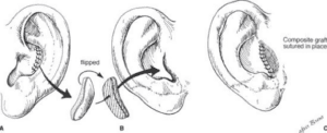 Stage 3 of the Brent method