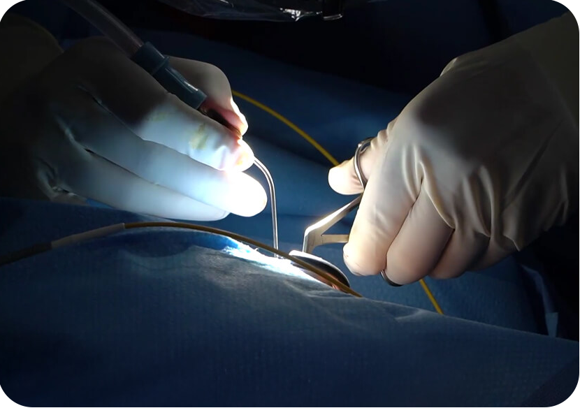 Preparation and Anesthesia